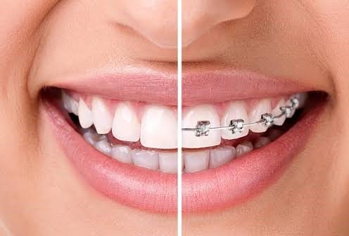 Orthodontics